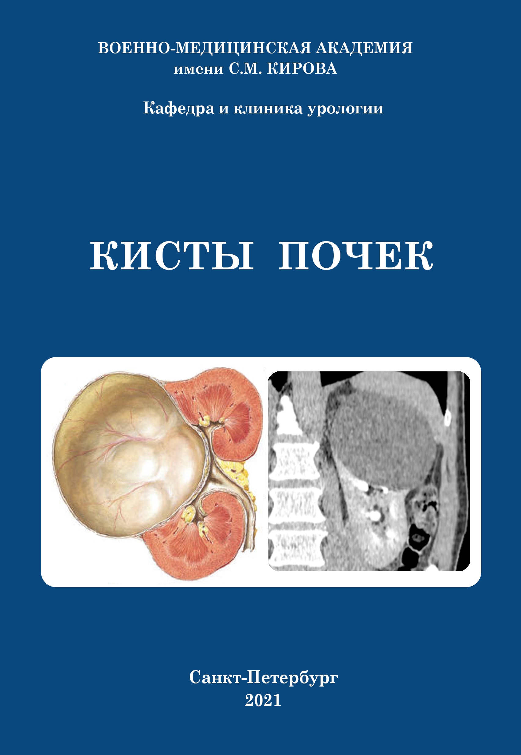                         Kidney cysts
            